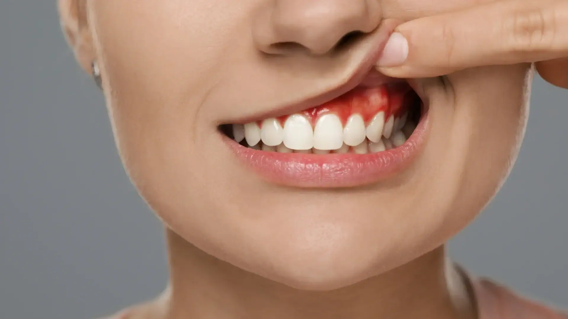 How Can You Prevent and Treat Gum Diseases Effectively?