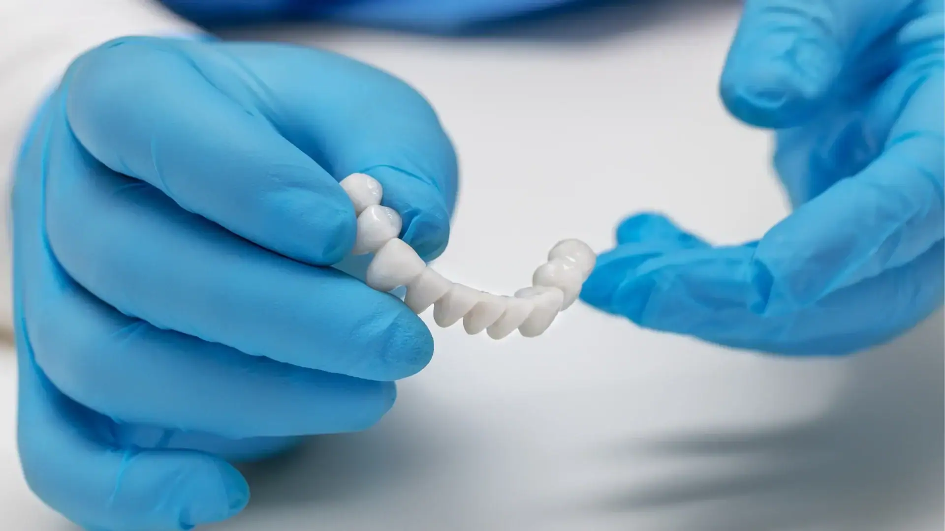 Zirconium Dental Crowns: Aesthetic Appeal with Durability