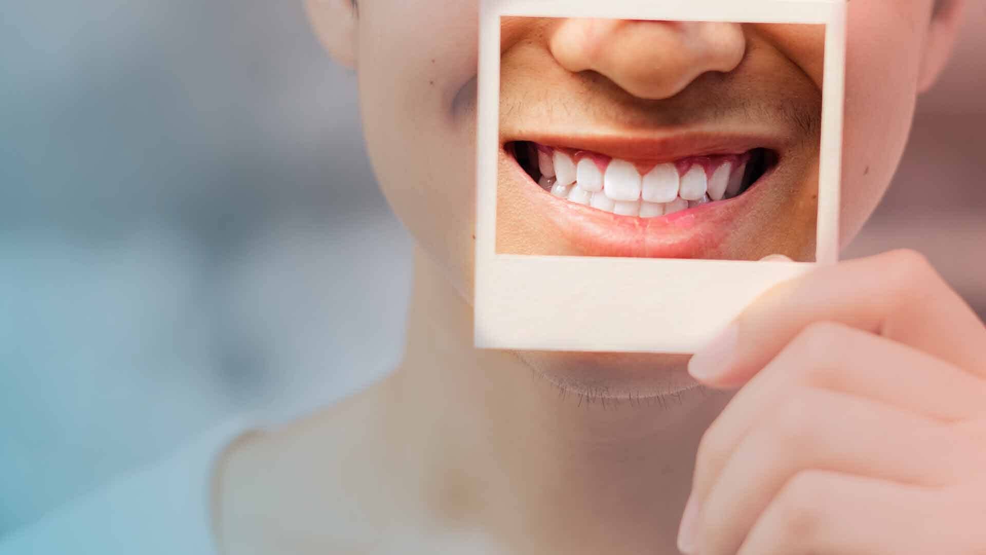 How Aesthetic Dentistry Can Boost Your Self-Confidence