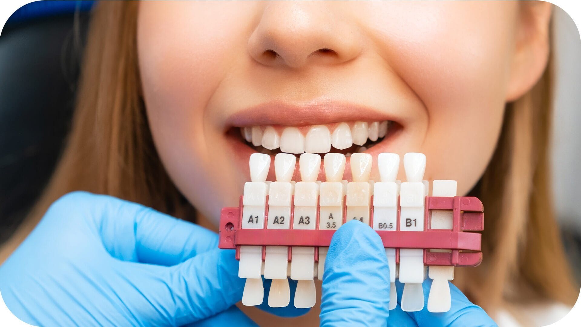 Teeth Whitening: Everything You Need to Know for a Bright and Healthy Smile