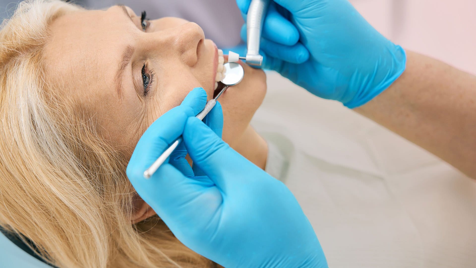 Dental Tartar Cleaning