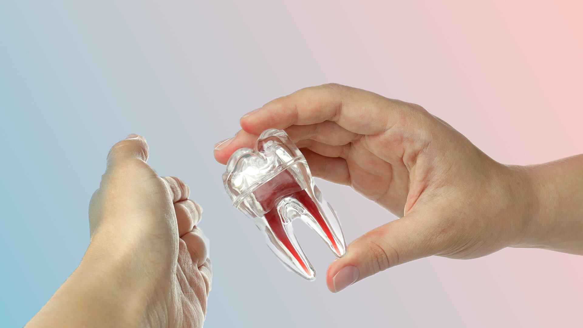 Semi-Erupted Wisdom Teeth