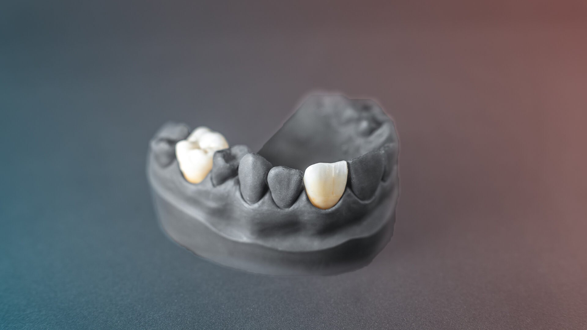 What is Zirconium Coating? Advantages, Application Process and Prices