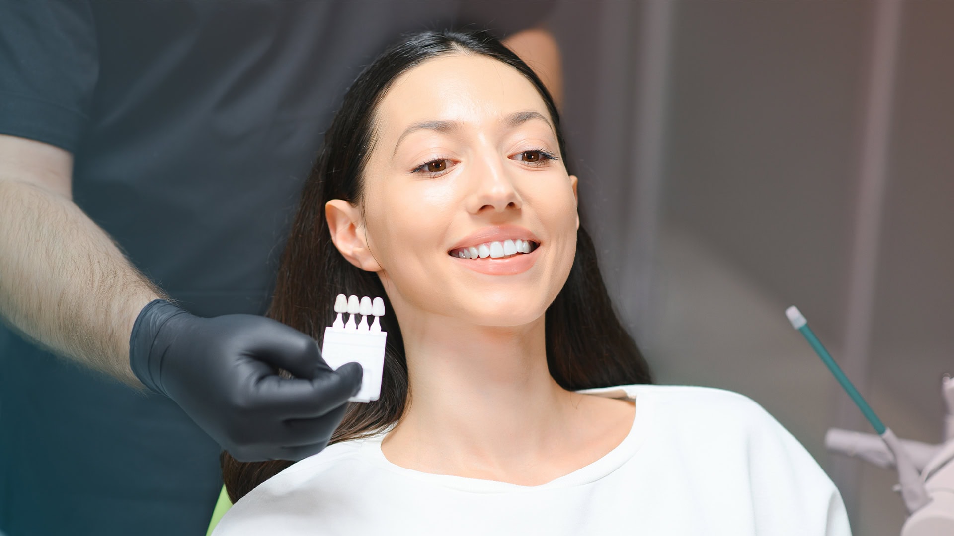 Emax Dental Veneers: The Perfect Harmony of Aesthe and Durability