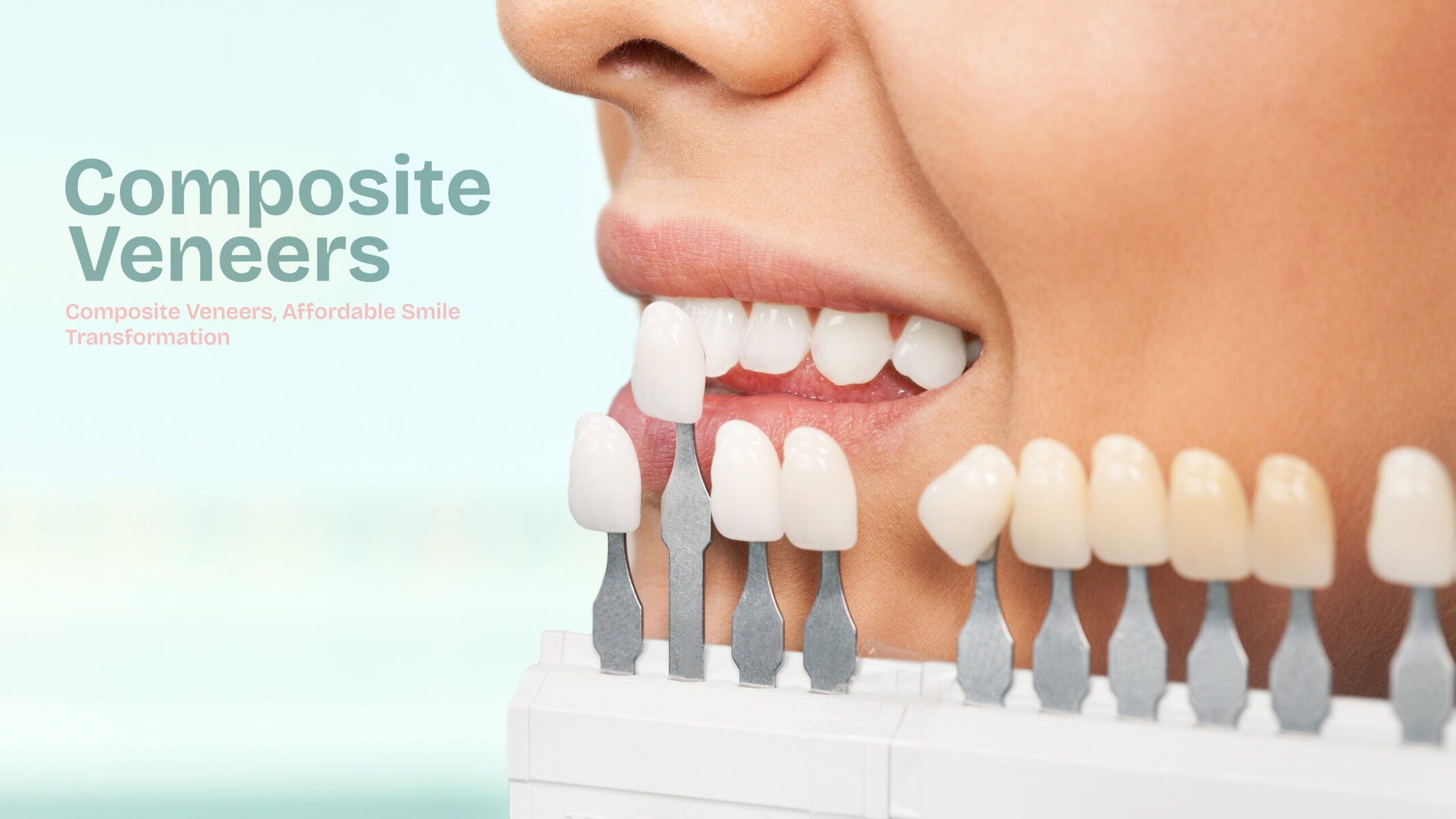 Transform Your Smile with Composite Veneers: Here's Everything You Need To Know About Composite Veneers