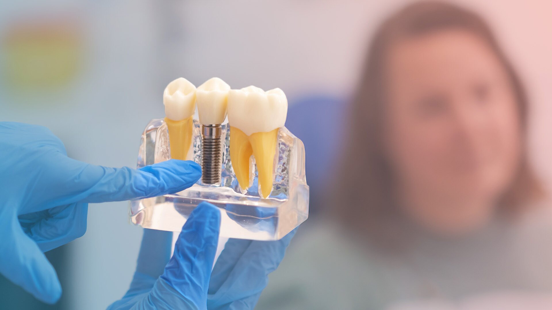 Gloved hands holding a clear jaw model with an implant crown between two natural teeth