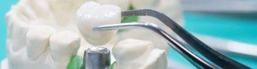 Blurred close-up of a plaster dental model and a metal surgical instrument