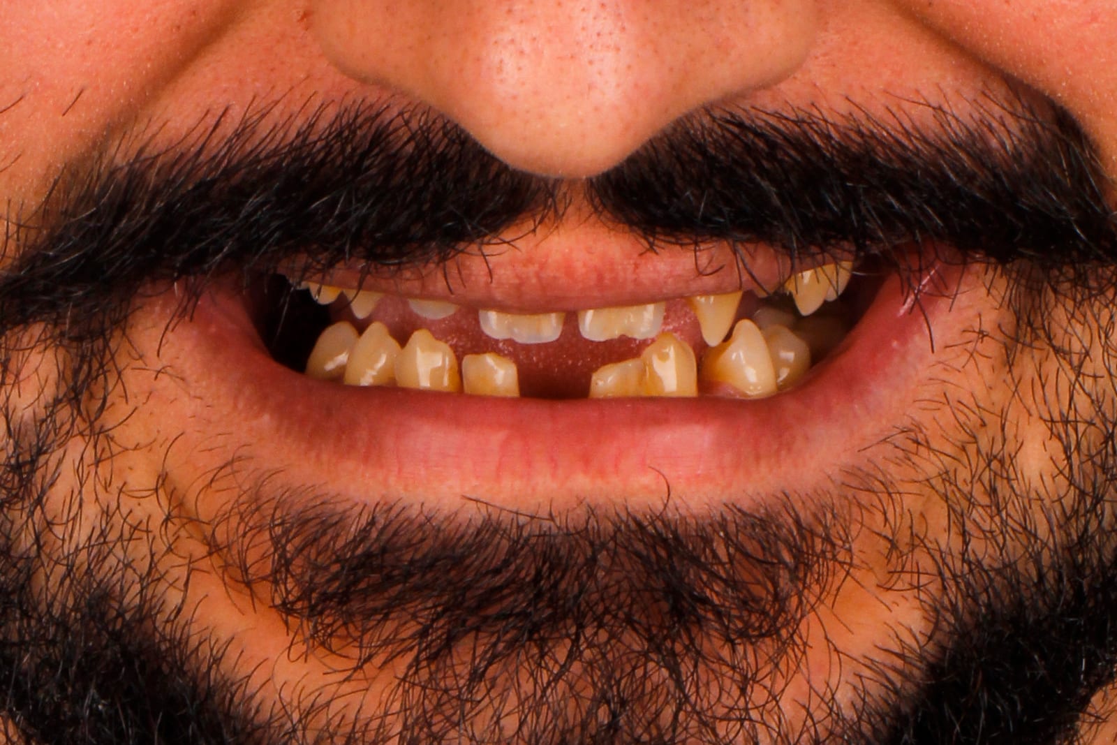Case 12 · intraoral close-up before treatment