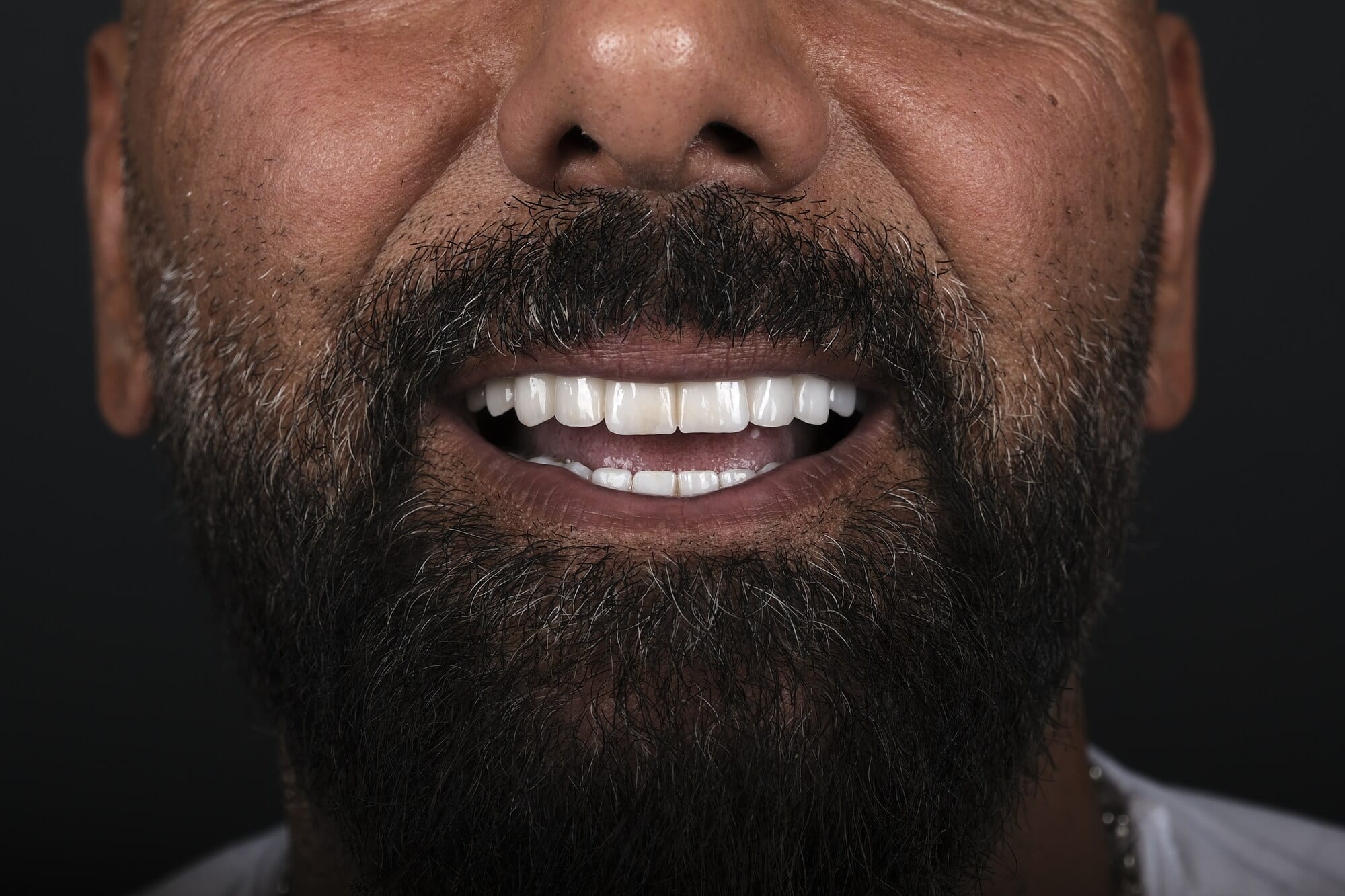 Case 17 · intraoral close-up after treatment