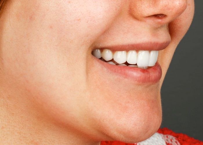 Case 7 · intraoral close-up after treatment