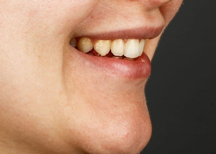 Case 7 · intraoral close-up before treatment