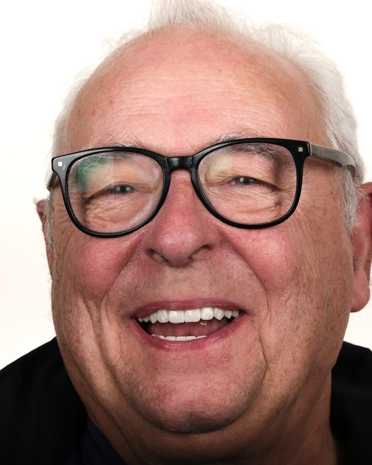 Case 1 · smile portrait after treatment