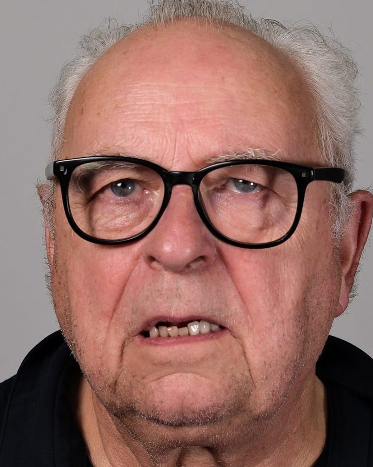 Case 1 · smile portrait before treatment