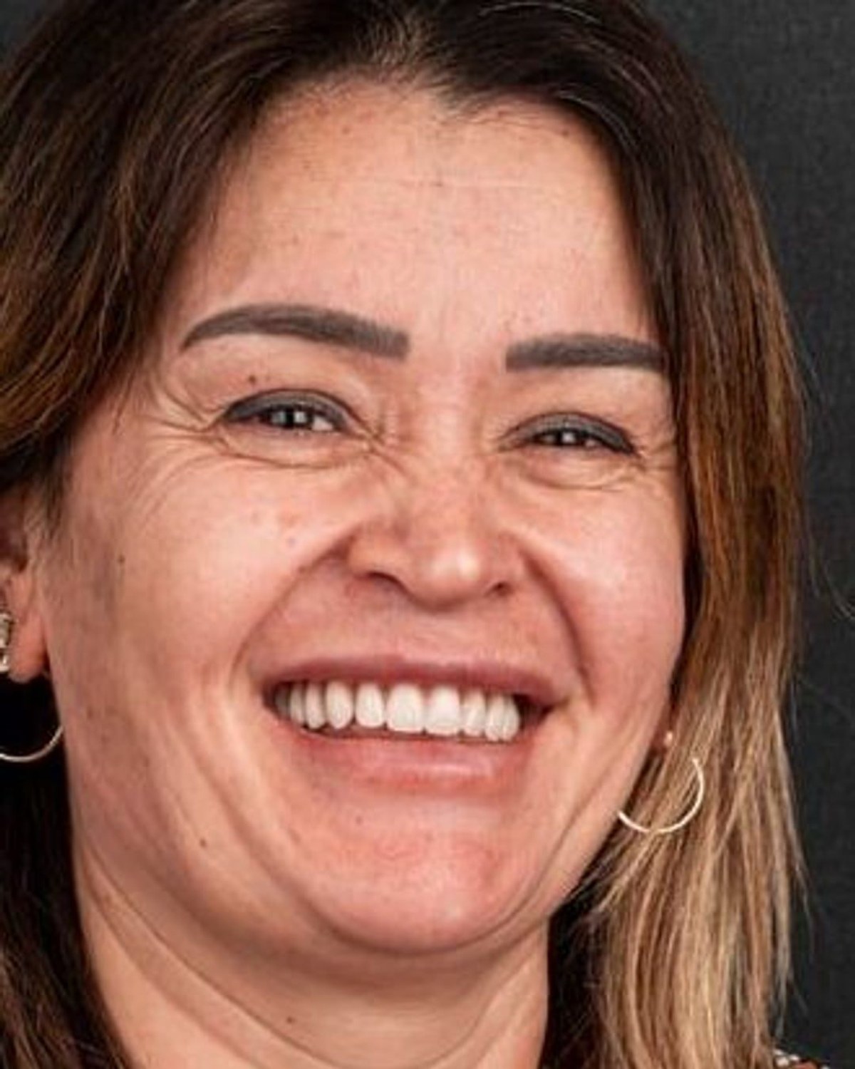 Case 10 · smile portrait after treatment