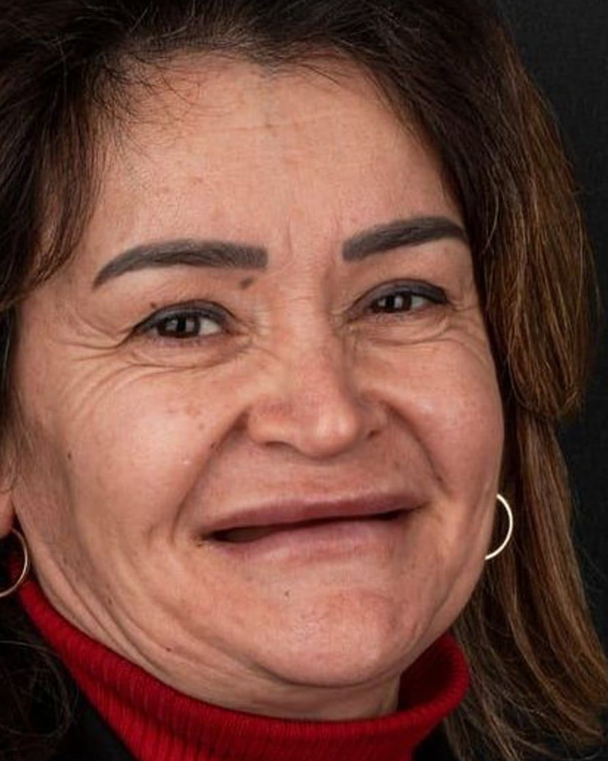 Case 10 · smile portrait before treatment