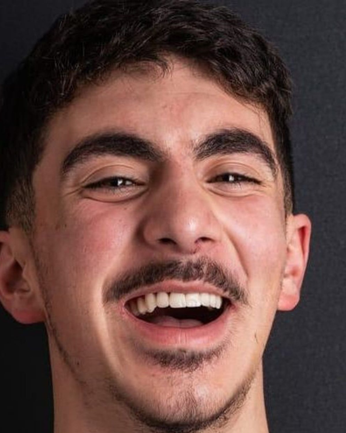 Case 12 · smile portrait after treatment