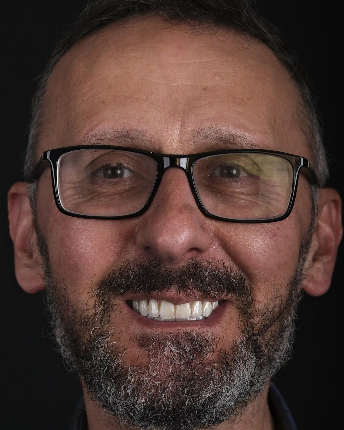 Case 17 · smile portrait after treatment