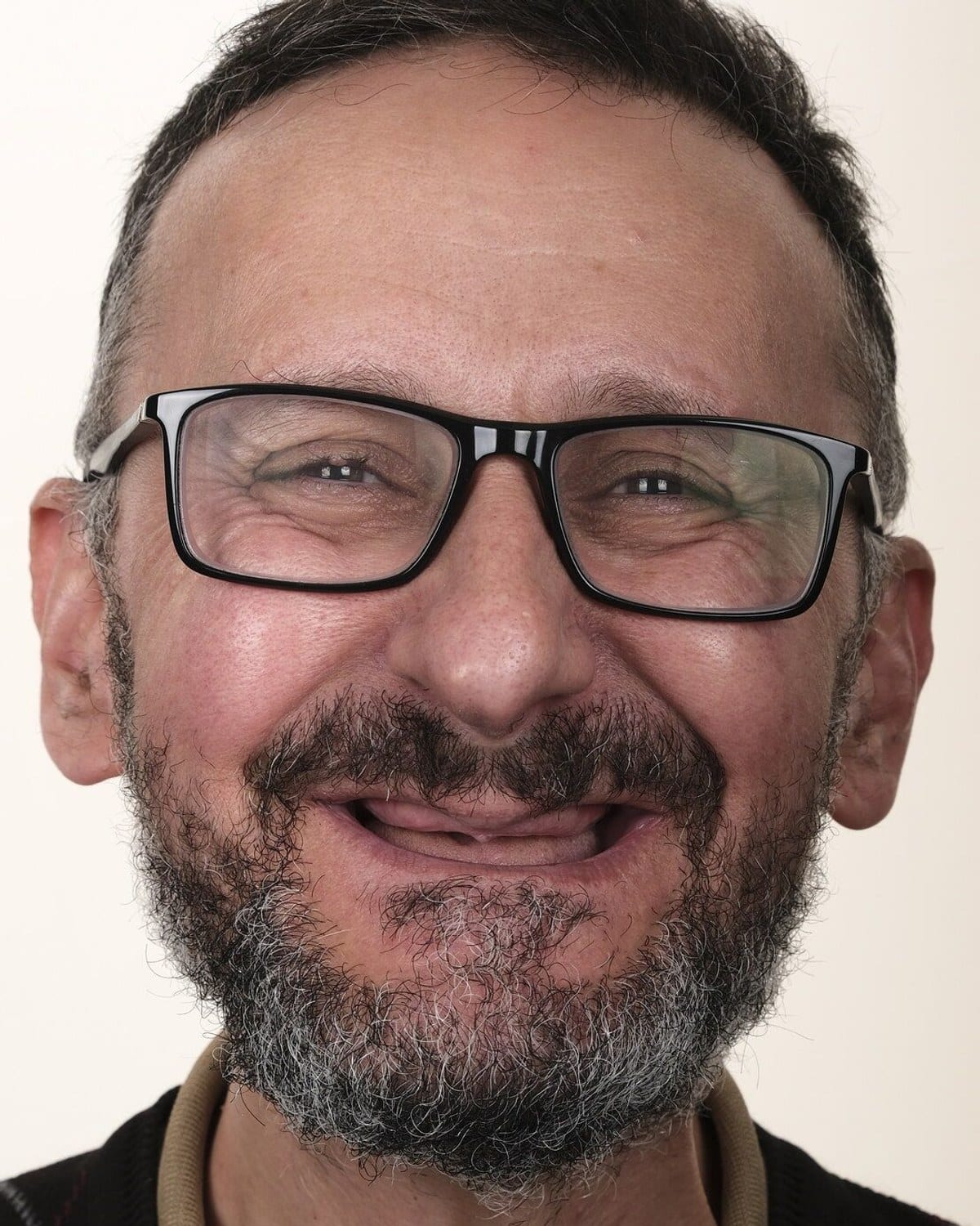 Case 17 · smile portrait before treatment
