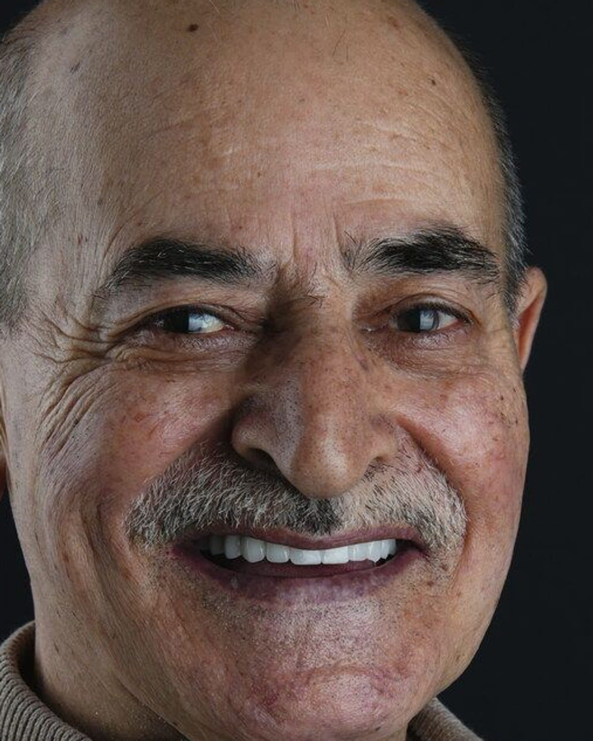 Case 18 · smile portrait after treatment