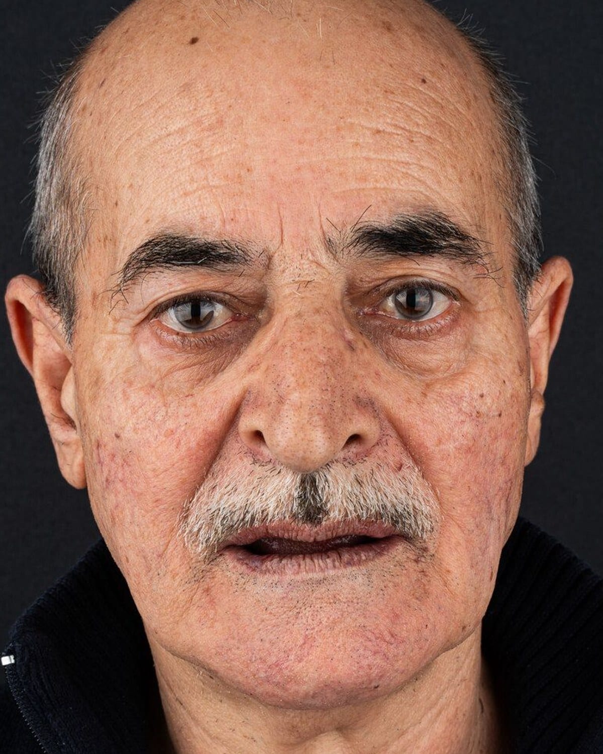Case 18 · smile portrait before treatment