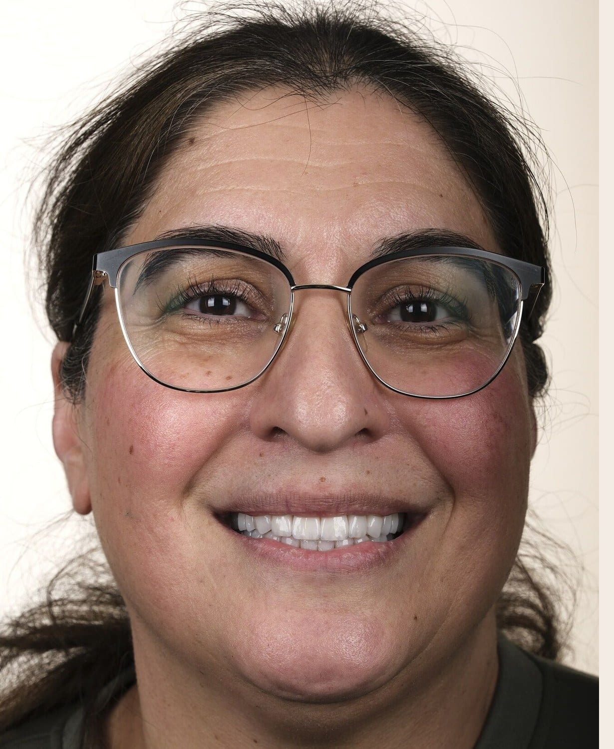 Case 19 · smile portrait after treatment