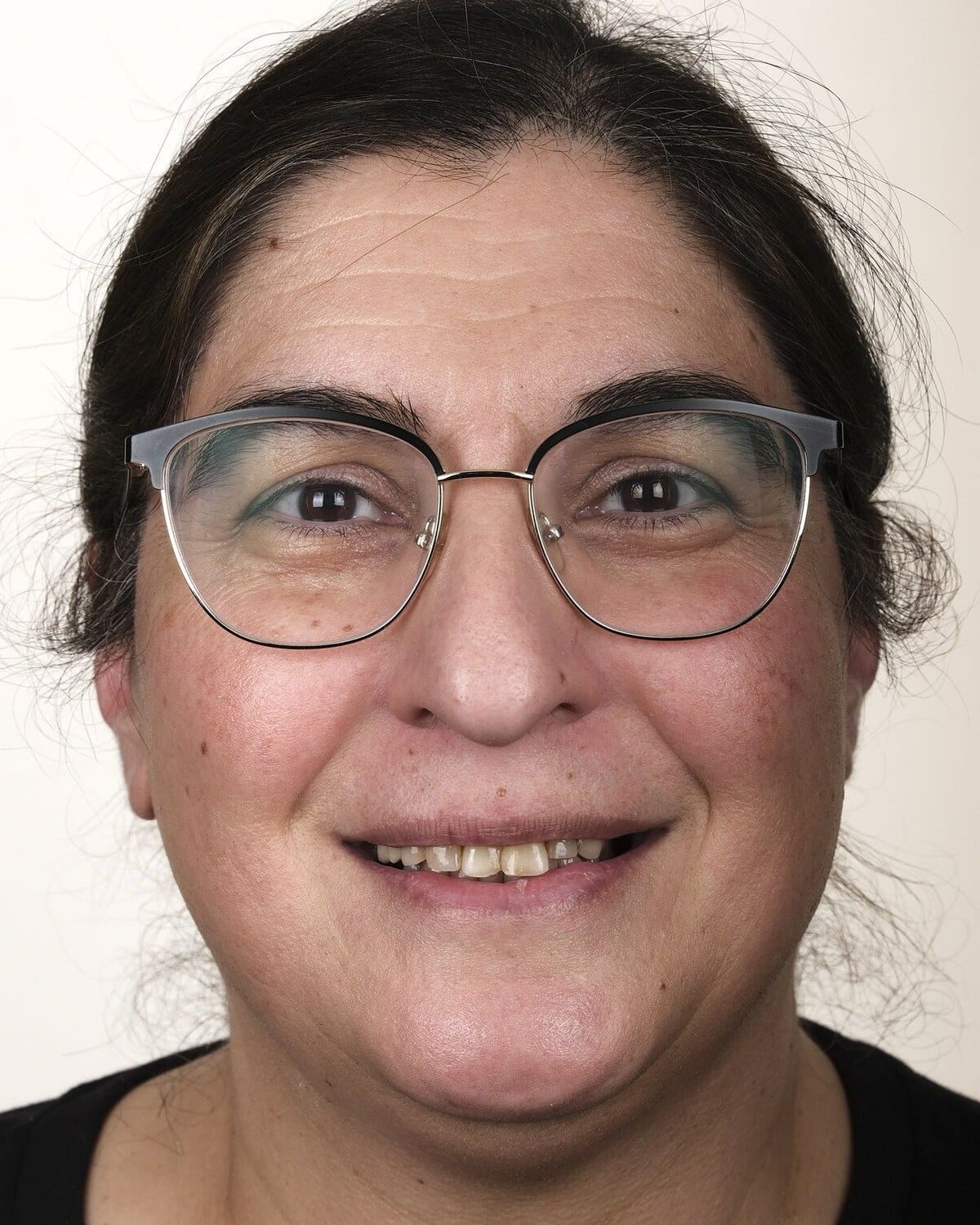 Case 19 · smile portrait before treatment