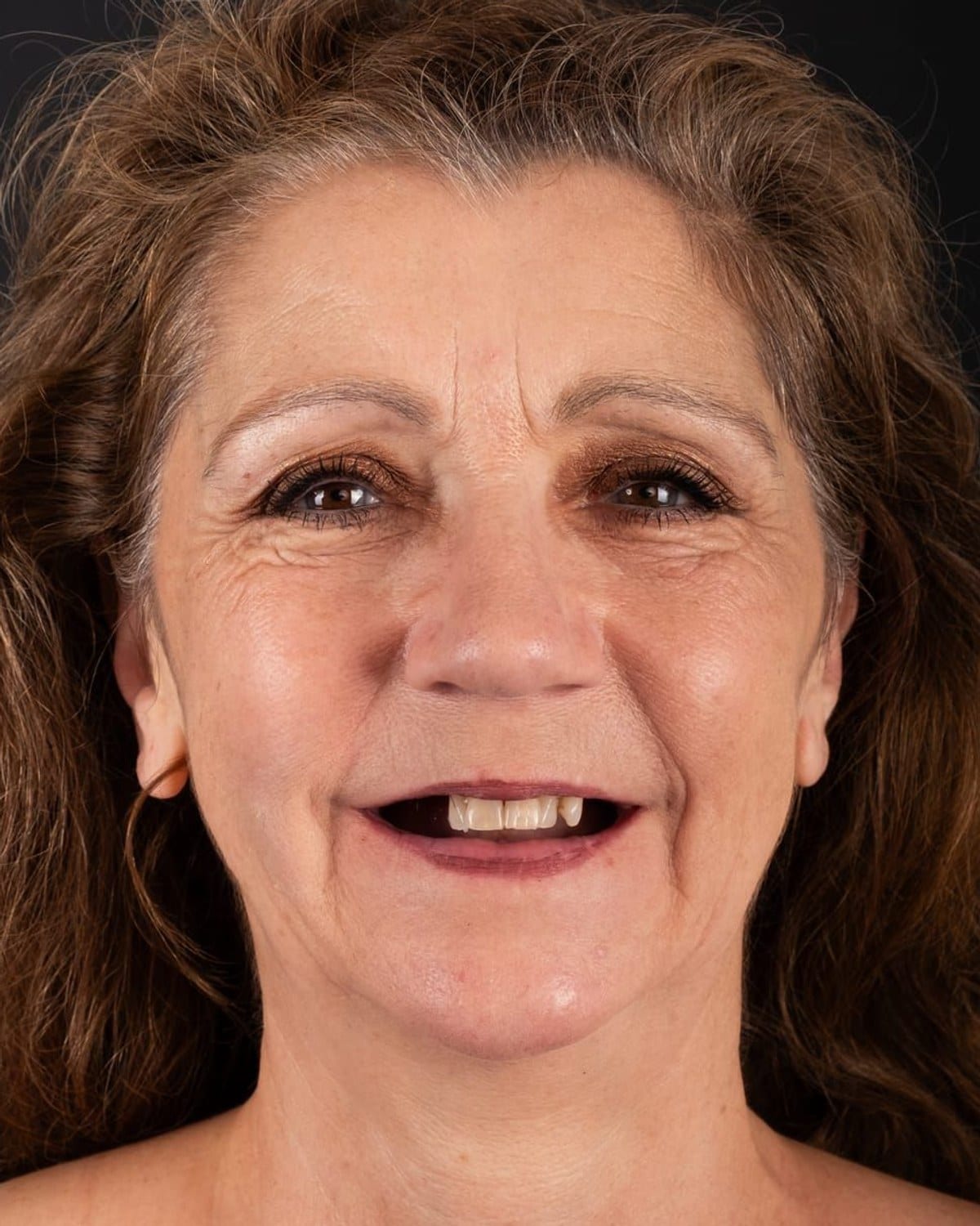 Case 2 · smile portrait before treatment
