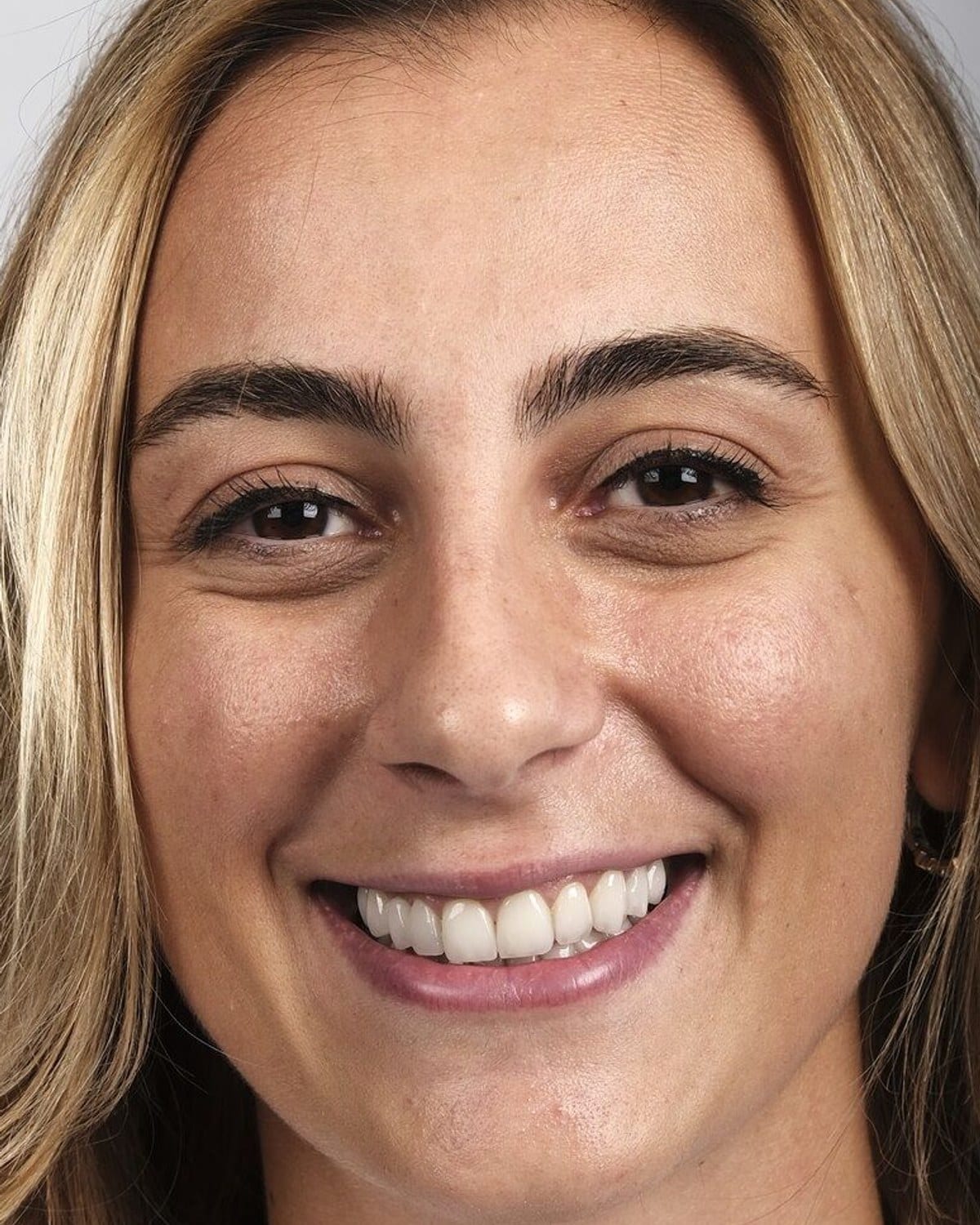 Case 20 · smile portrait after treatment