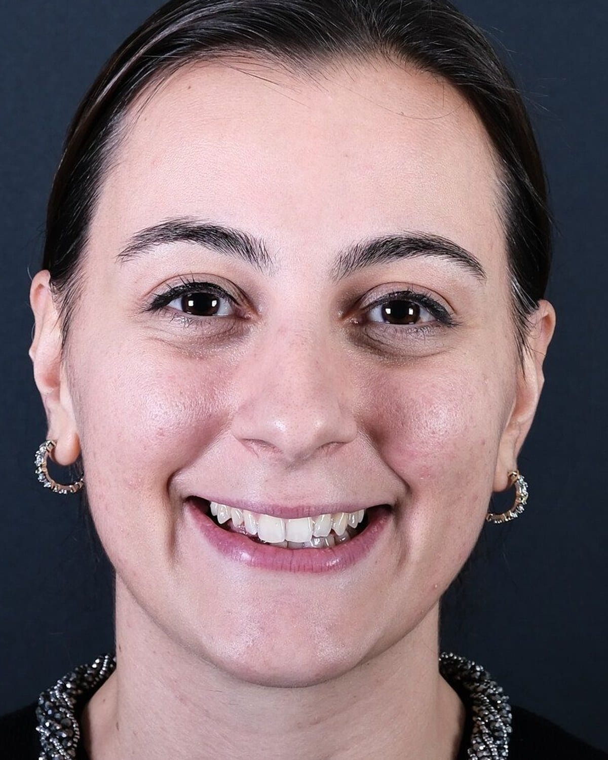 Case 20 · smile portrait before treatment
