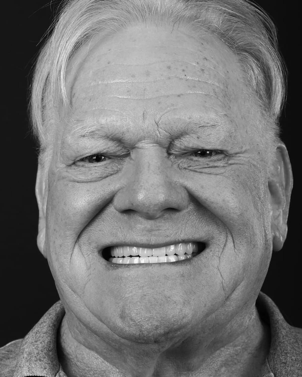 Case 3 · smile portrait after treatment