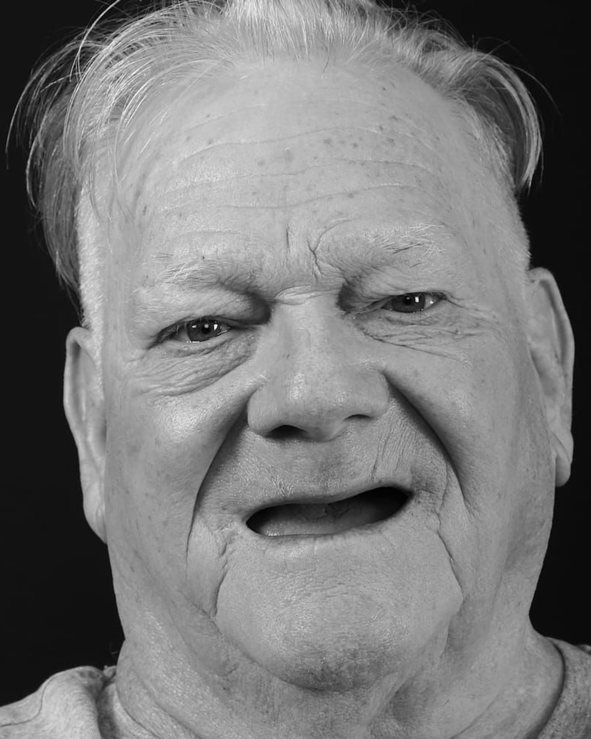 Case 3 · smile portrait before treatment