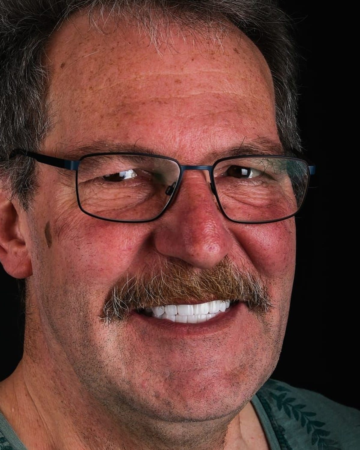 Case 5 · smile portrait after treatment