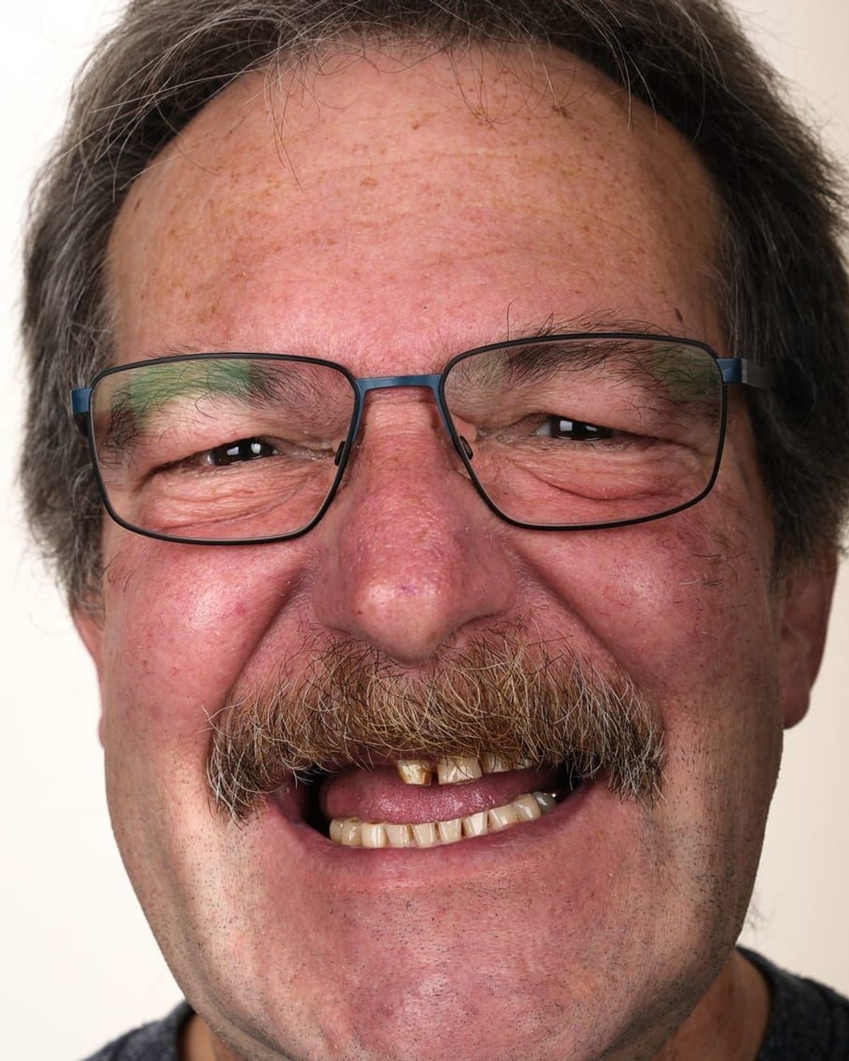 Case 5 · smile portrait before treatment