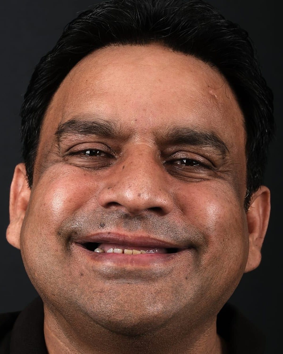 Case 6 · smile portrait before treatment