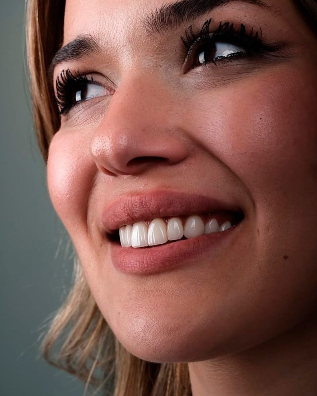 Case 7 · smile portrait after treatment