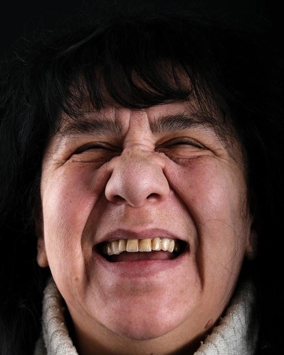Case 8 · smile portrait before treatment