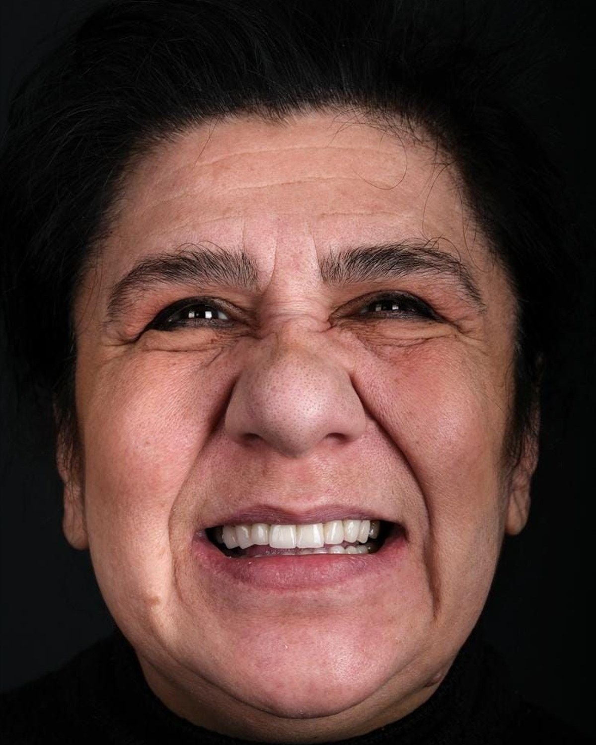 Case 8 · smile portrait after treatment