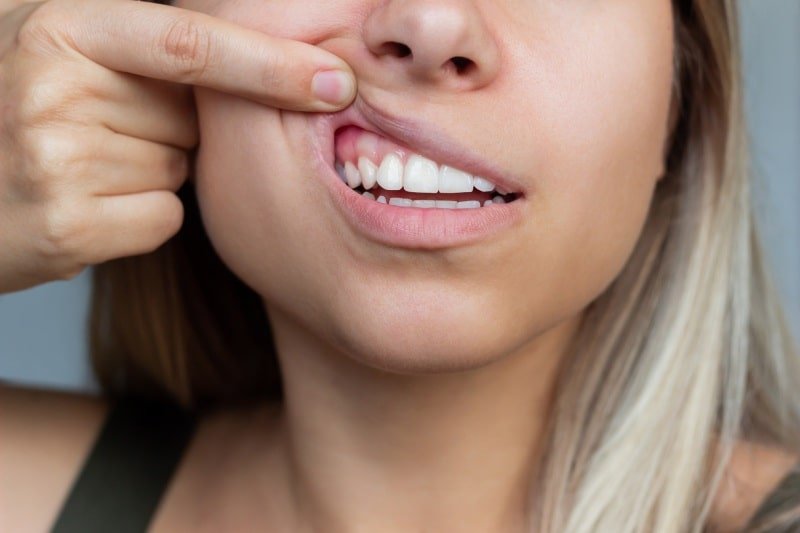 Gum