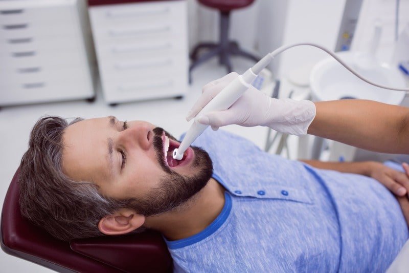 Root Canal