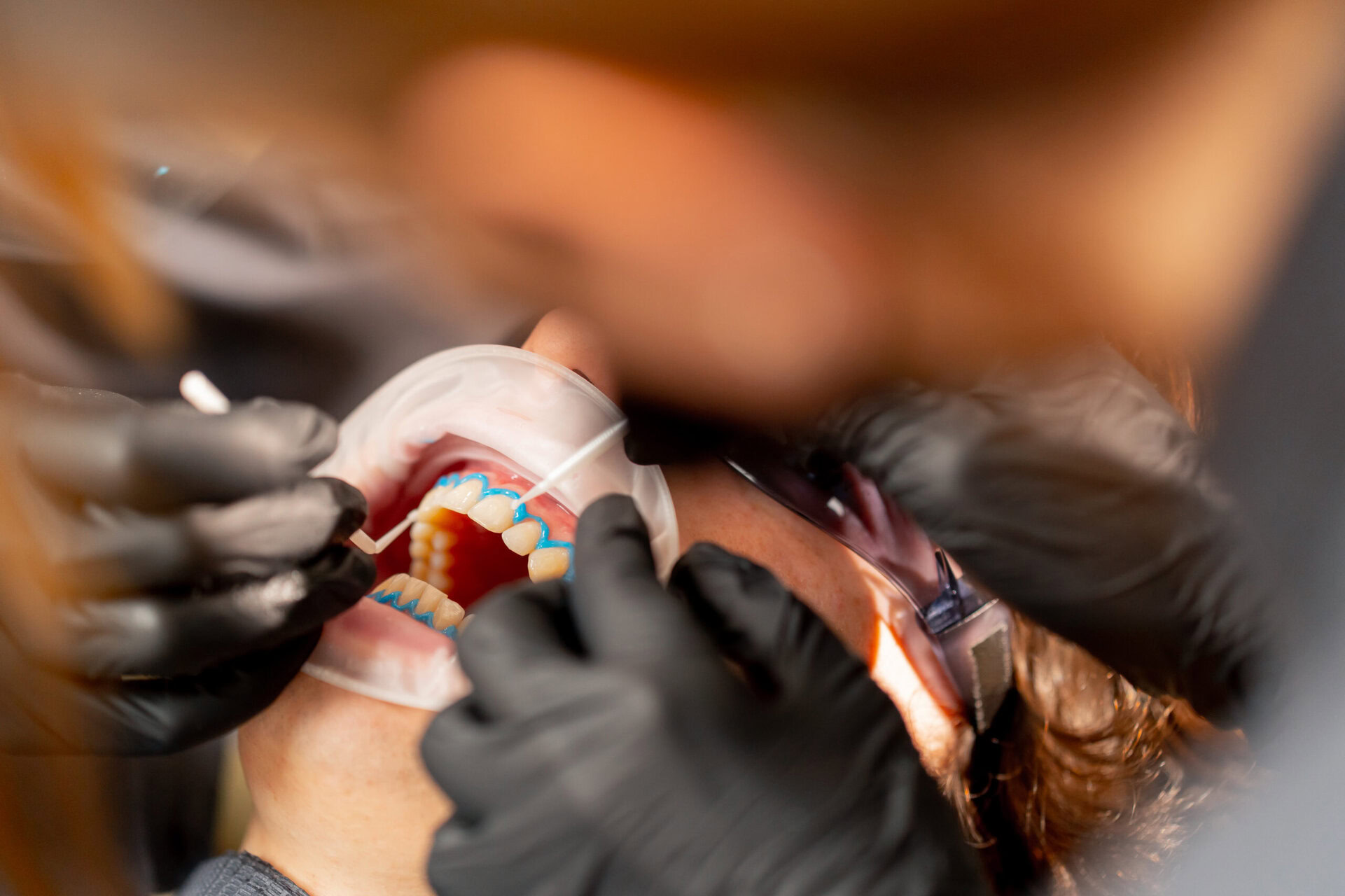 Teeth