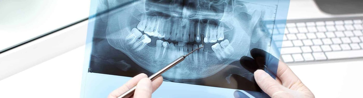 Dental Radiology