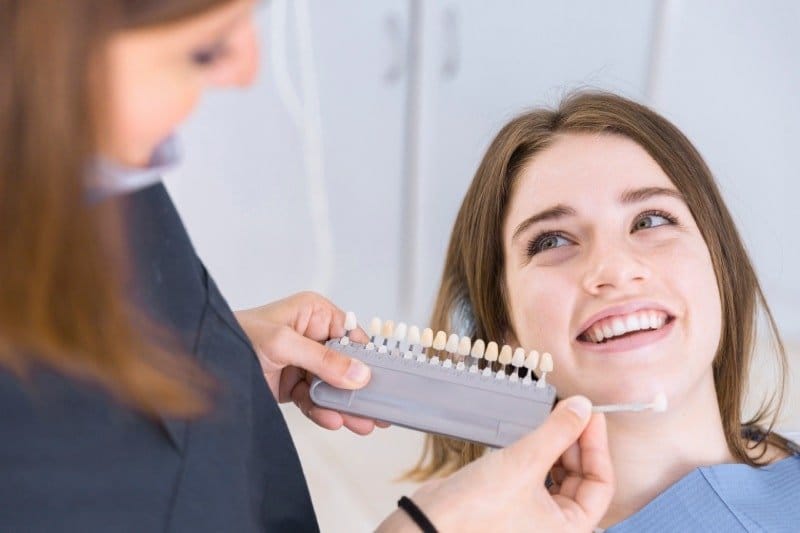 Prepless Veneer