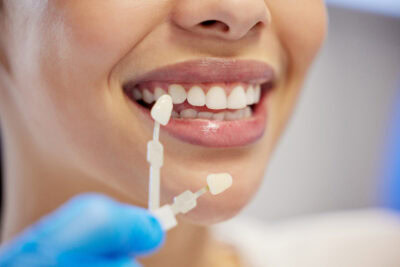 zirconium crowns
