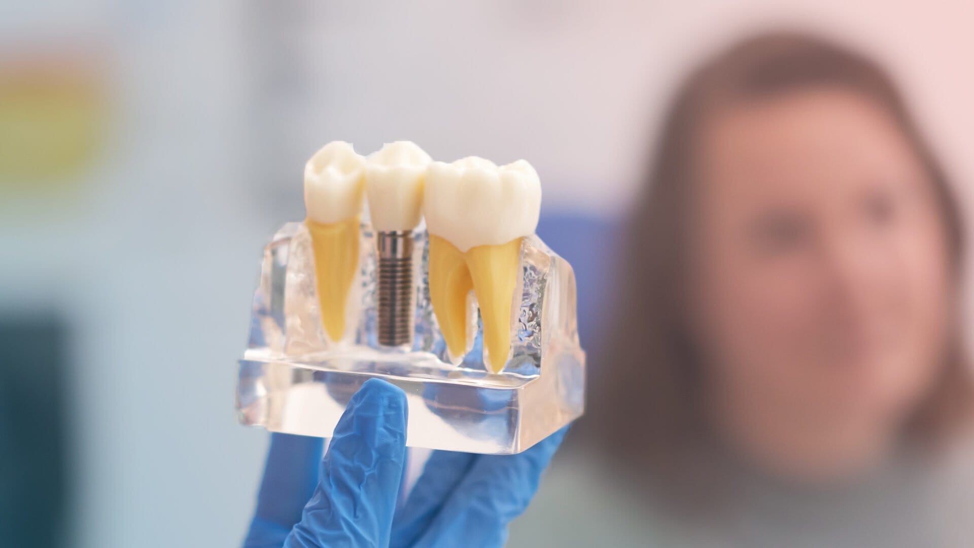 Post-Implant Care and Recovery Process