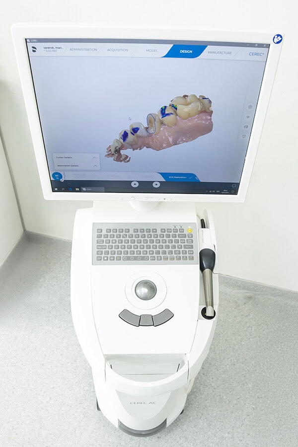 3d intraoral scanners