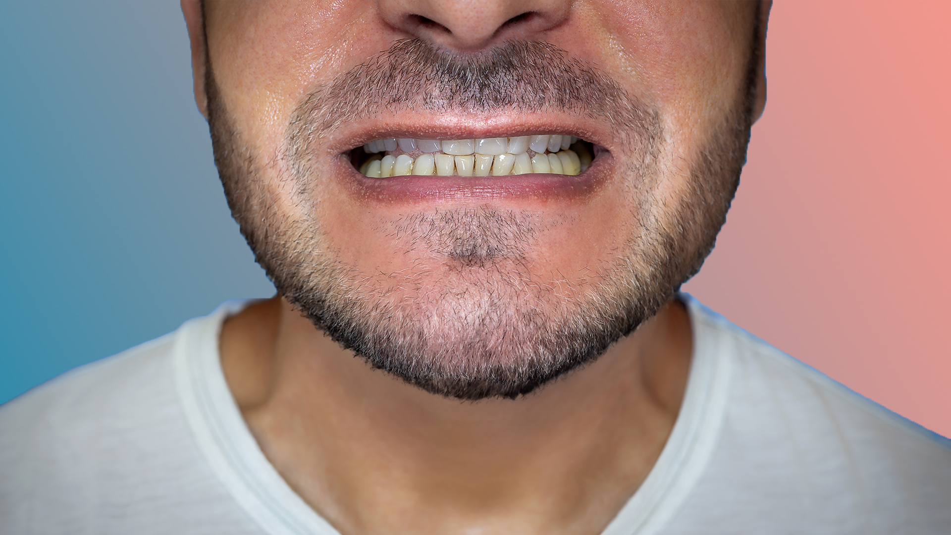 Crooked Teeth