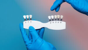Laminate Veneers Teeth: A Minimalist Smile Makeover with Maximum Impact