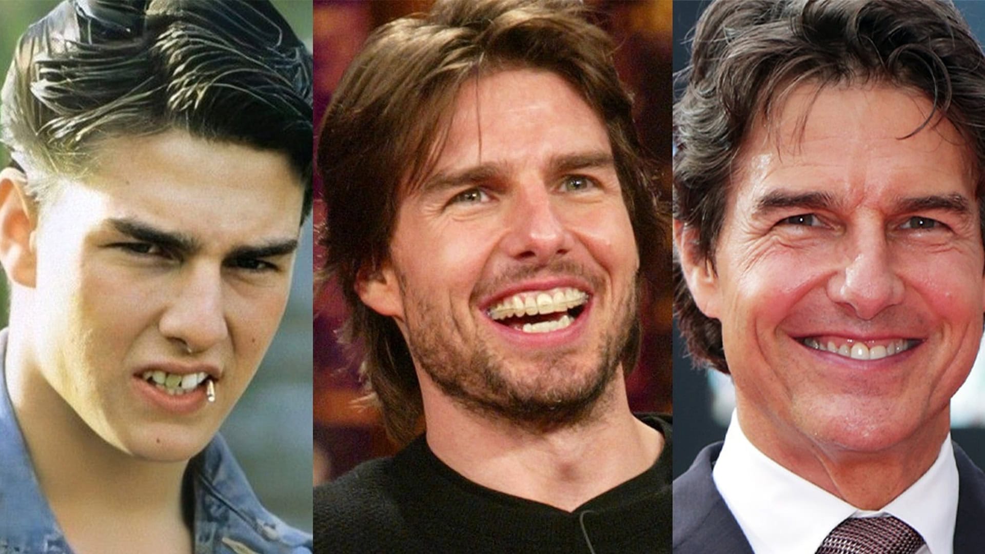 Tom Cruise's Teeth: The Evolution of the Hollywood Smile