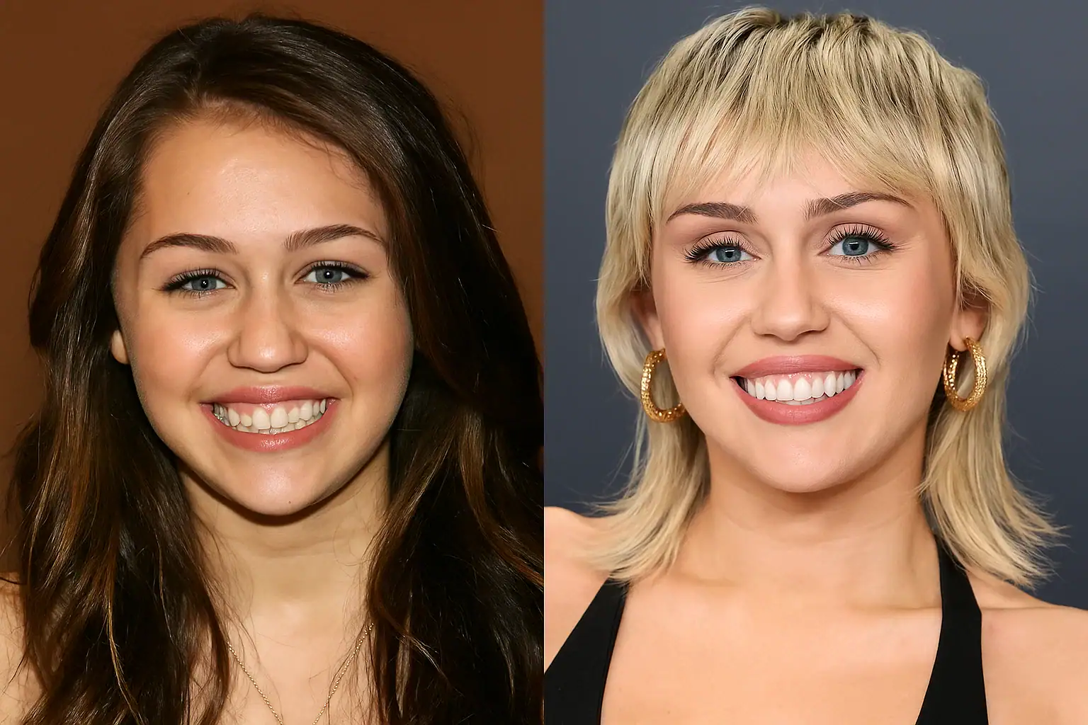 Miley Cyrus and Veneers
