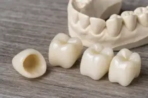 Zirconia Crowns Explained